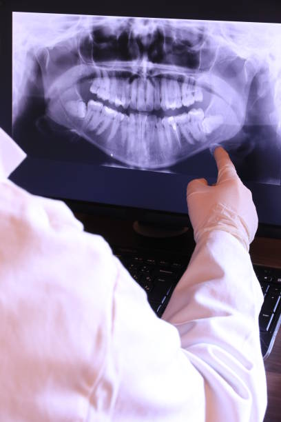 Best Emergency Dentist for Lost Fillings or Crowns in Bowman, ND