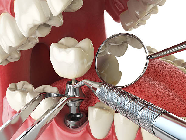 Best Pediatric Emergency Dentist in Bowman, ND